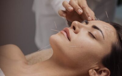 Facial Acupuncture For Youthful Skin Naturally – Special Offer