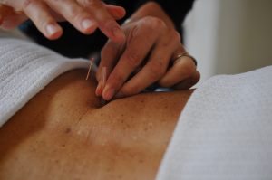 Acupuncture for pain management