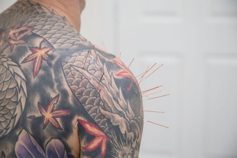 Acupuncture with Tiffany Black