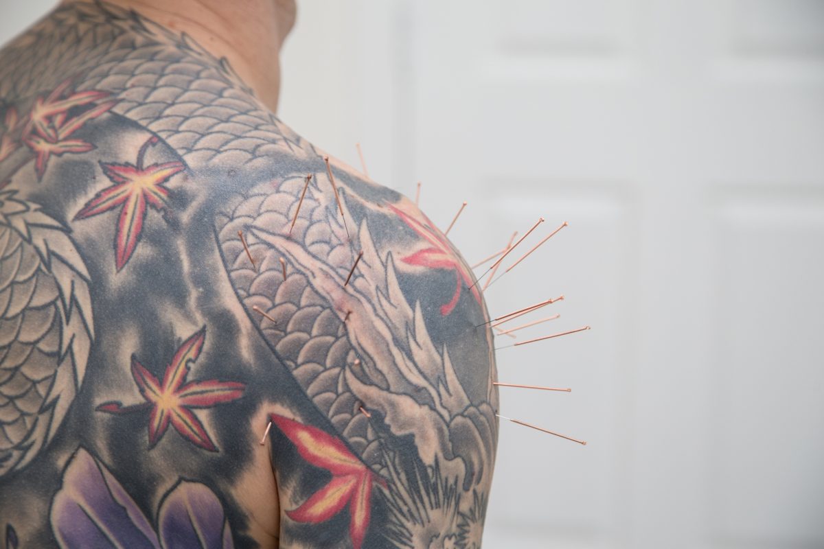Acupuncture with Tiffany Black